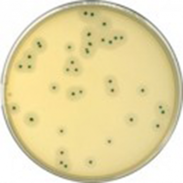 Gélose Baird-Parker jaune...