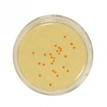 Contact PCA + TTC +...