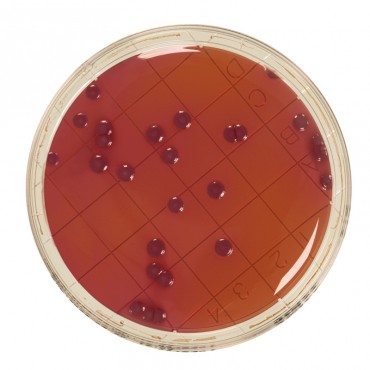 Contact VRBG + Neutralizers