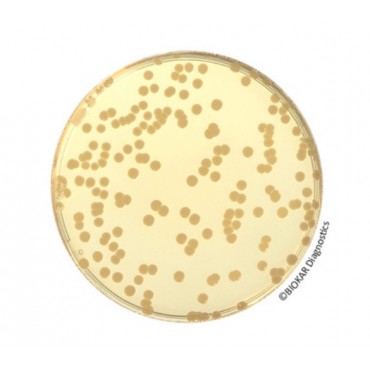 Plate Count Agar (PCA) (RTU) Ready to Use culture media Biokar