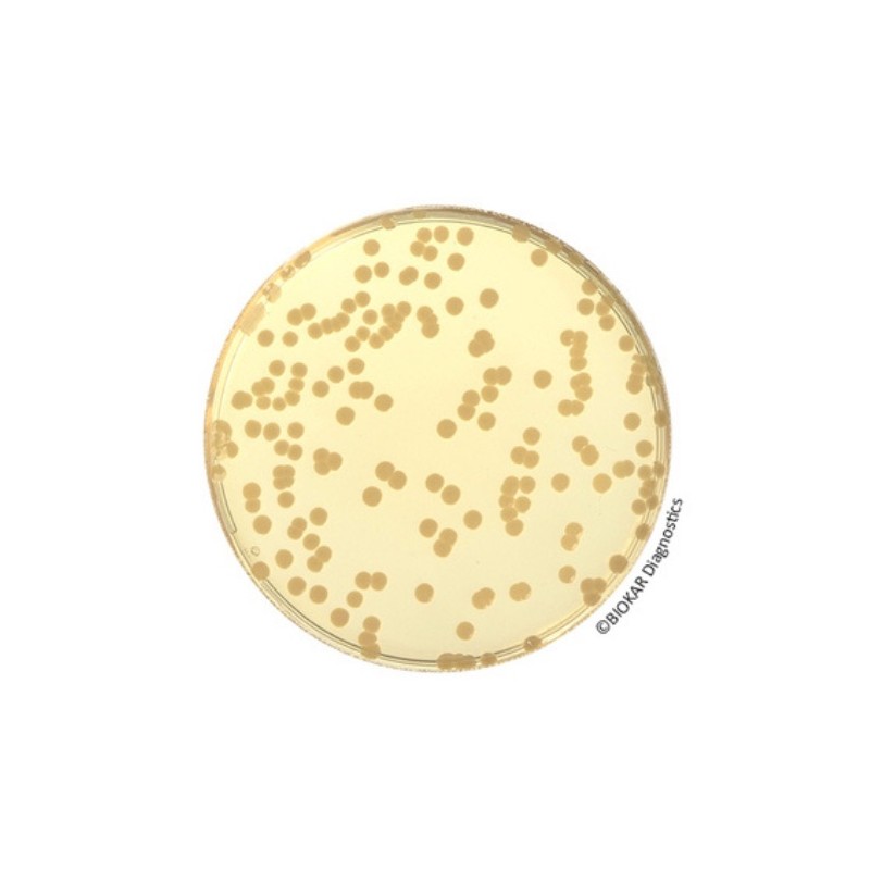 Plate Count Agar (PCA) (RTU) Ready to Use culture media Biokar